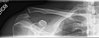 xray0003.jpg