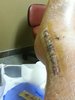 ankle 1 2014.jpg