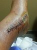 ankle 1a 2014.jpg