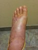 ankle 1b 2014.jpg