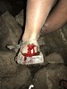 photo thumbnail #15